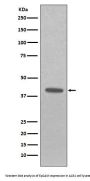 Anti-EpCAM/Trop1 Rabbit Monoclonal Antibody