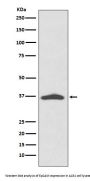 Anti-EpCAM/Trop1 Rabbit Monoclonal Antibody