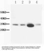 Anti-Calbindin-D Calb1 Antibody (Monoclonal, CB-955)