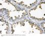 Anti-Episialin, EMA MUC1 Antibody (Monoclonal, GP1.4)