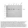 Anti-Smad4(DPC4) Antibody (Monoclonal, DCS-46)