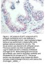 Anti-Akt phospho S473 Monoclonal Antibody