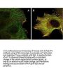 Anti-Akt phospho S473 Monoclonal Antibody