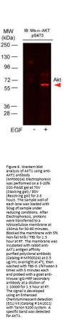Anti-Akt phospho S473 Monoclonal Antibody