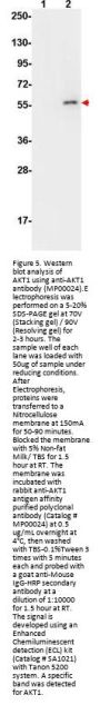 Anti-Akt phospho S473 Monoclonal Antibody