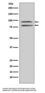 Anti-Phospho-MSK1 (S376) RPS6KA5 Monoclonal Antibody