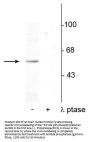 Anti-Phospho-p53 (Ser392) TP53 Antibody