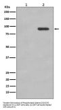 Anti-Phospho-beta Catenin (S33/S37) CTNNB1 Rabbit Monoclonal Antibody