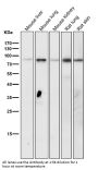 Anti-Phospho-STAT3 (Y705) Rabbit Monoclonal Antibody
