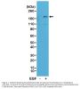 Anti-Phospho-EGFR (Y1173) Rabbit Monoclonal Antibody, Clone#RM269