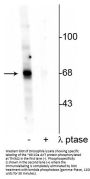 Anti-Phospho-AKT (Thr342) AKT1 Antibody