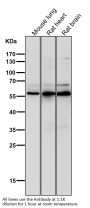 Anti-Phospho-AKT1 (S124) Rabbit Monoclonal Antibody