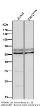 Anti-Phospho-AKT1 (S124) Rabbit Monoclonal Antibody