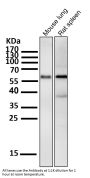 Anti-Phospho-Akt (Ser473) AKT1 Rabbit Monoclonal Antibody
