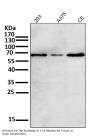 Anti-Phospho-Akt (Ser473) AKT1 Rabbit Monoclonal Antibody