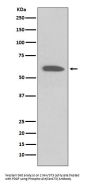 Anti-Phospho-Akt (Ser473) AKT1 Rabbit Monoclonal Antibody