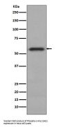 Anti-Phospho-c-Myc (S62) Rabbit Monoclonal Antibody