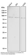 Anti-Phospho-STAT1 (Y701) Rabbit Monoclonal Antibody
