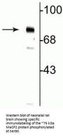 Anti-Phospho-MeCP2 (Ser80) Antibody