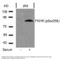 Anti-Phospho-FKHR (Ser256) FOXO1 Antibody