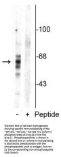 Anti-Phospho-Tau (Ser416) MAPT Antibody