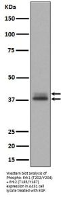 Anti-Phospho-Erk1 (T202/Y204) + Erk2 (T185/Y187) MAPK3 Rabbit Monoclonal Antibody