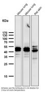 Anti-Phospho-Erk1 (T202/Y204) + Erk2 (T185/Y187) MAPK3 Rabbit Monoclonal Antibody