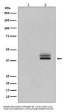 Anti-Phospho-Erk1 (T202/Y204) + Erk2 (T185/Y187) MAPK3 Rabbit Monoclonal Antibody