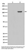 Anti-Phospho-FAK (Y397) PTK2 Rabbit Monoclonal Antibody