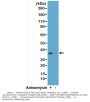 Anti-p38 MAPK Phospho (pT180/pY182) MAPK14 Rabbit Monoclonal Antibody, Clone#RM243