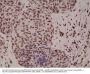 Anti-p38 MAPK Phospho (pT180/pY182) MAPK14 Rabbit Monoclonal Antibody, Clone#RM243