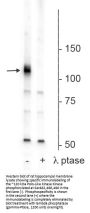 Anti-Phospho-Polo-Like Kinase Kinase (Ser482,486,490) PLK1 Antibody