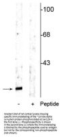 Anti-Phospho-Alpha Synuclein (Ser129) SNCA Antibody