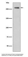 Anti-Phospho-LRRK2 (S935) Rabbit Monoclonal Antibody