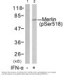 Anti-Phospho-Merlin (Ser518) NF2 Antibody