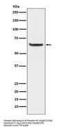 Anti-Phospho-NF-Kappa B p65 (S529) RELA Rabbit Monoclonal Antibody