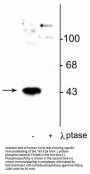Anti-Phospho-MEK1 (Thr386) MAP2K1 Antibody