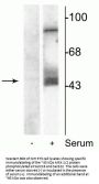 Anti-Phospho-MEK1/2 (Ser218,222) MAP2K1 Antibody