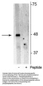 Anti-Phospho-p62 (Ser28) SQSTM1 Antibody