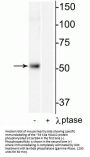 Anti-Phospho-HDAC2 (Ser394) Antibody