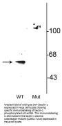 Anti-Phospho-Beclin-1 (Ser295) BECN1 Antibody