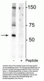 Anti-Phospho-Dopamine Transporter (DAT) (Thr53) Antibody