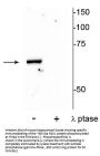 Anti-Phospho-PAK1 (Thr84) Antibody