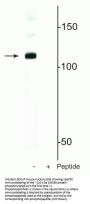 Anti-Phospho-DiGeorge Syndrome Critical Region 8 DGCR8 (Ser377) Antibody