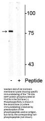 Anti-Phospho-Serotonin Transporter (Thr276) SLC6A4 Antibody