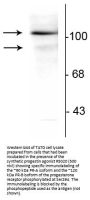 Anti-Phospho-Progesterone Receptor (Ser294) PGR Antibody