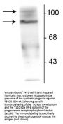 Anti-Phospho-Progesterone Receptor (Ser190) PGR Antibody