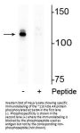 Anti-Phospho-Androgen Receptor (AR) (Ser94) Antibody