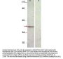 Anti-Phospho-Aurora B pT232 Aurkb Antibody