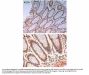 Anti-Phospho-Aurora B pT232 Aurkb Antibody